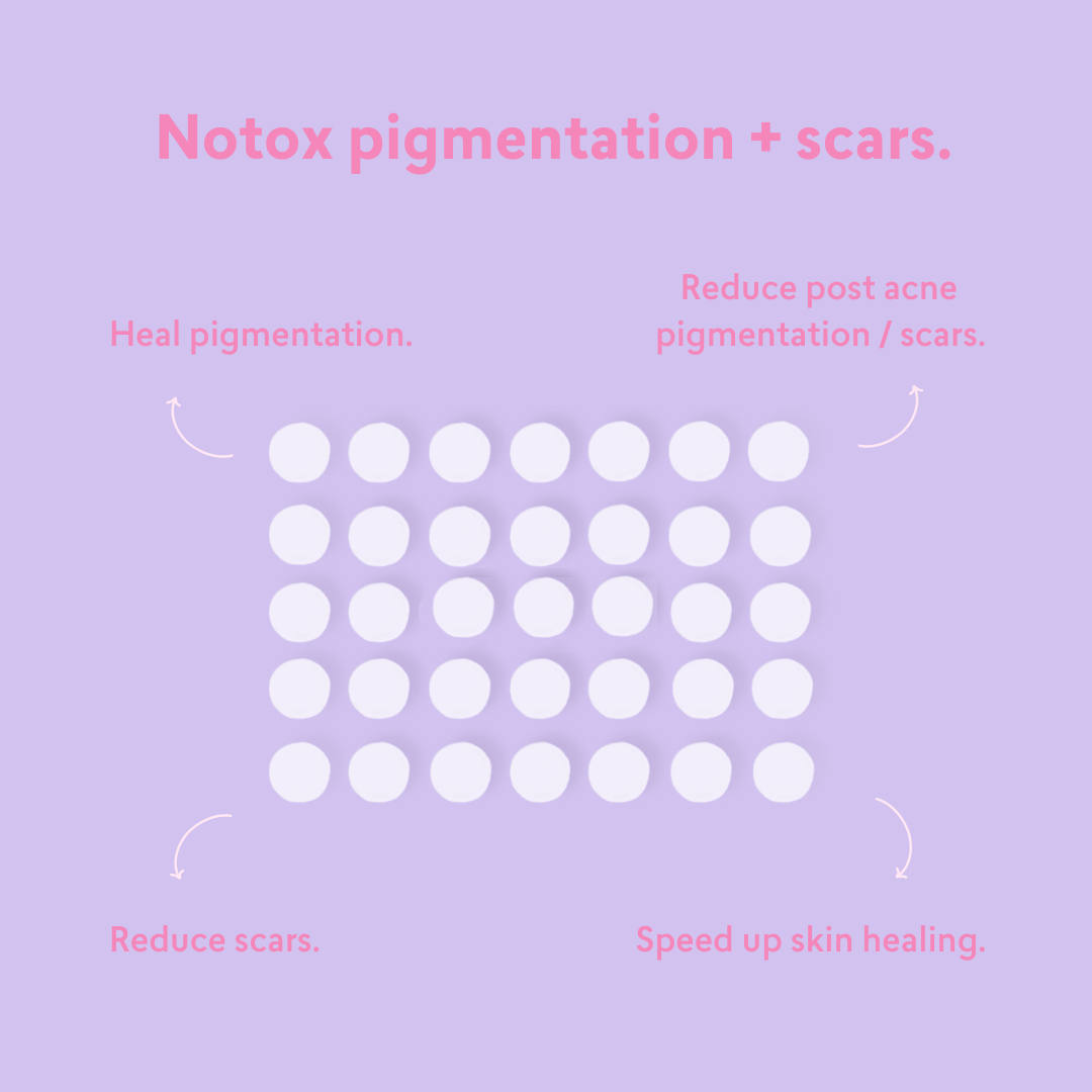 Notox - Pigmentation + Scar Silicone Patches