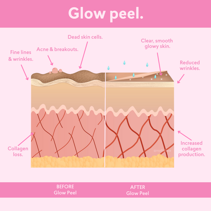 Glow Peel - At Home Chemical Peel