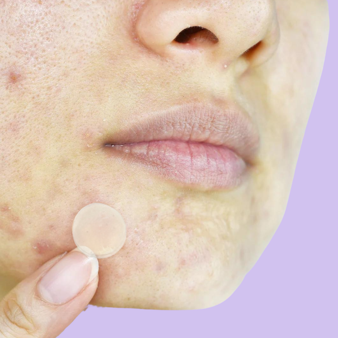 Notox - Pigmentation + Scar Silicone Patches