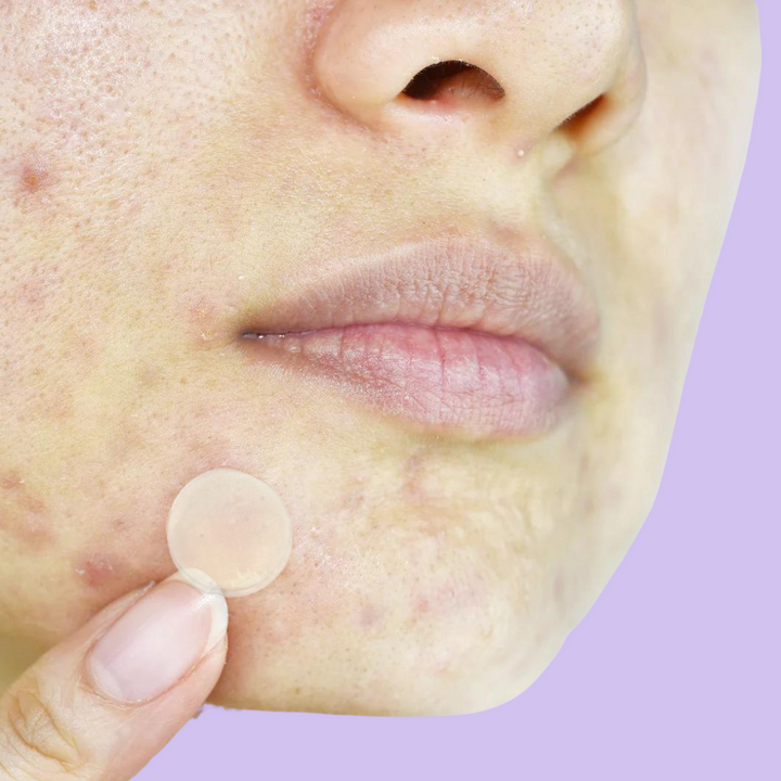 Notox - Pigmentation + Scar Silicone Patches