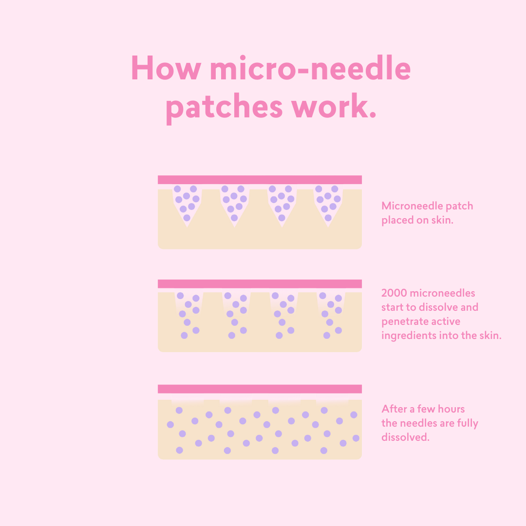 Eye Booster - Micro-Needle Patches - (4 pack)