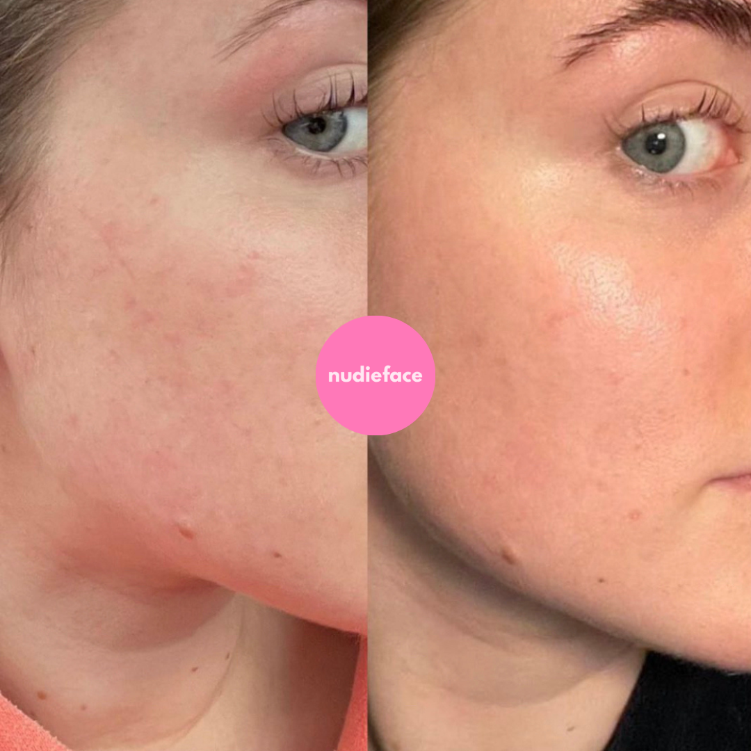 Skin Booster Serum
