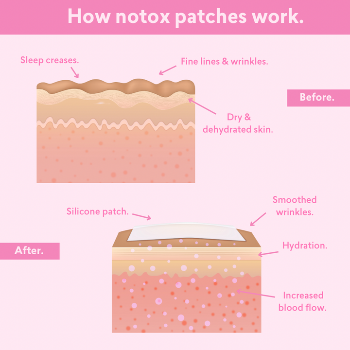 Notox - Chest + Body Silicone Wrinkle Patch