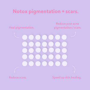 Notox - Pigmentation + Scar Silicone Patches