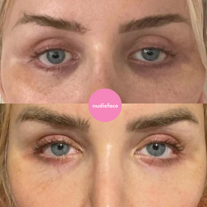 Eye Booster - Micro-Needle Patches